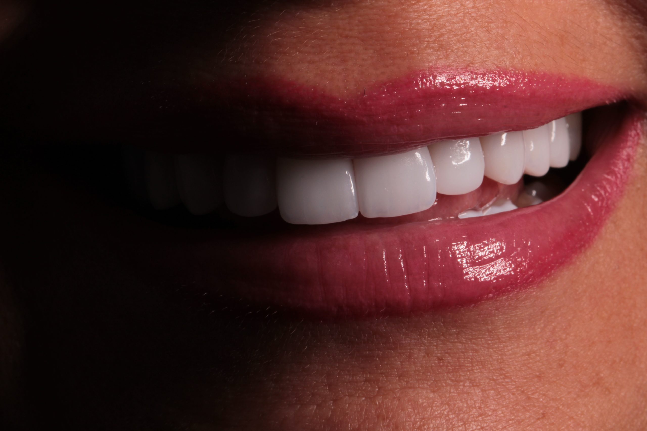 Dental Aesthetics